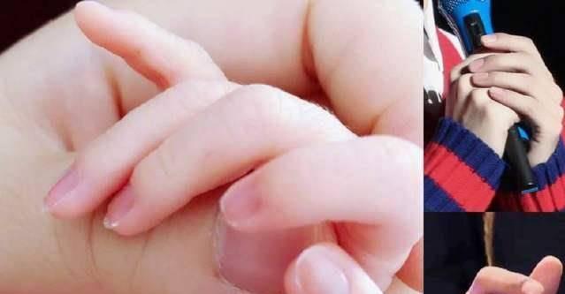 小手指短的人命苦么？弹钢琴技巧与适应方法